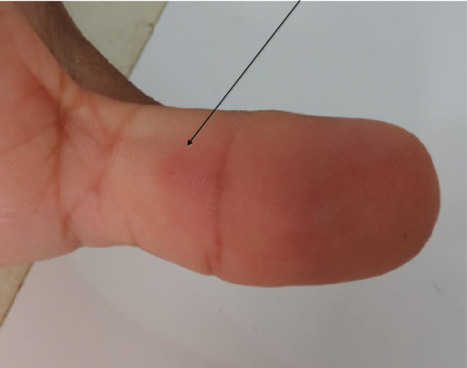 File:PMC4395898 40409 2014 85 Fig2 HTML.png