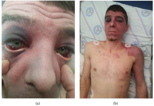 File:PMC4458292 CRIEM2015-359814.001.png