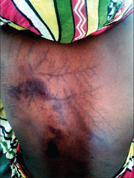 File:PMC4763624 IJD-61-109-g002.png