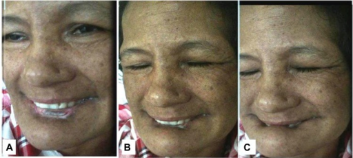 File:PMC4772938 imcrj-9-039Fig1.png