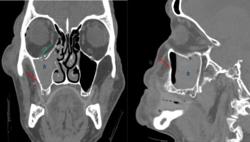 File:PMC4786376 cureus-0008-000000000487-i01.png