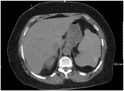 File:PMC4800468 10.1177 2324709616638363-fig1.png