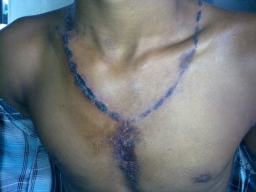 File:PMC4891493 CCR3-4-618-g001.png