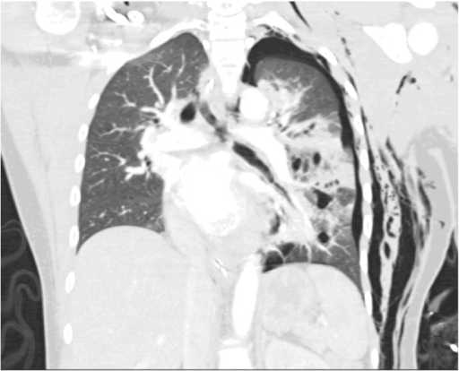 File:PMC5021783 gr2.png