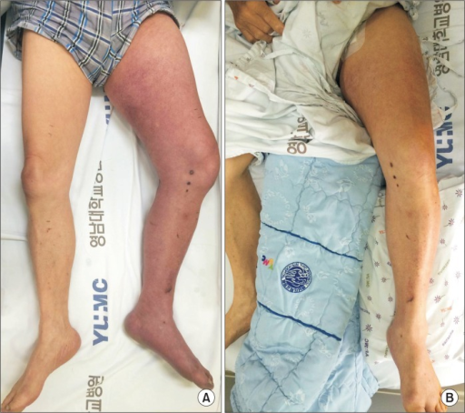 File:PMC5198769 vsi-32-201f1.png