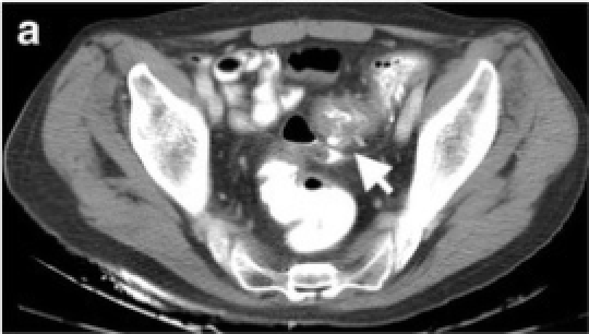 File:PMC5265196 13244 2016 532 Fig7 HTML.png