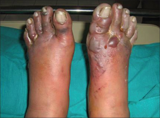 File:PMC5286755 IJD-62-59-g009.png