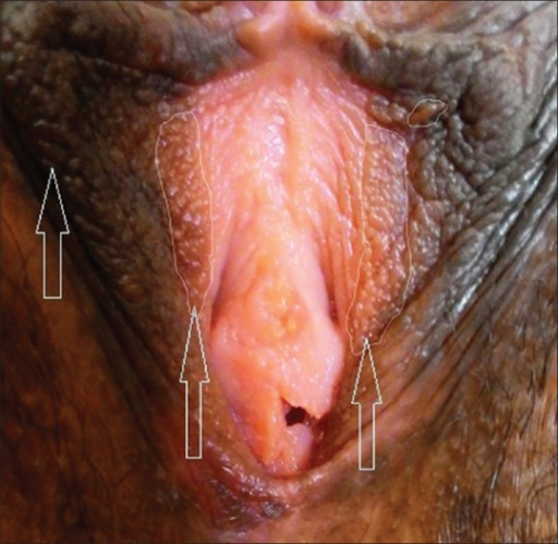 File:PMC5297281 IDOJ-8-63-g001.png