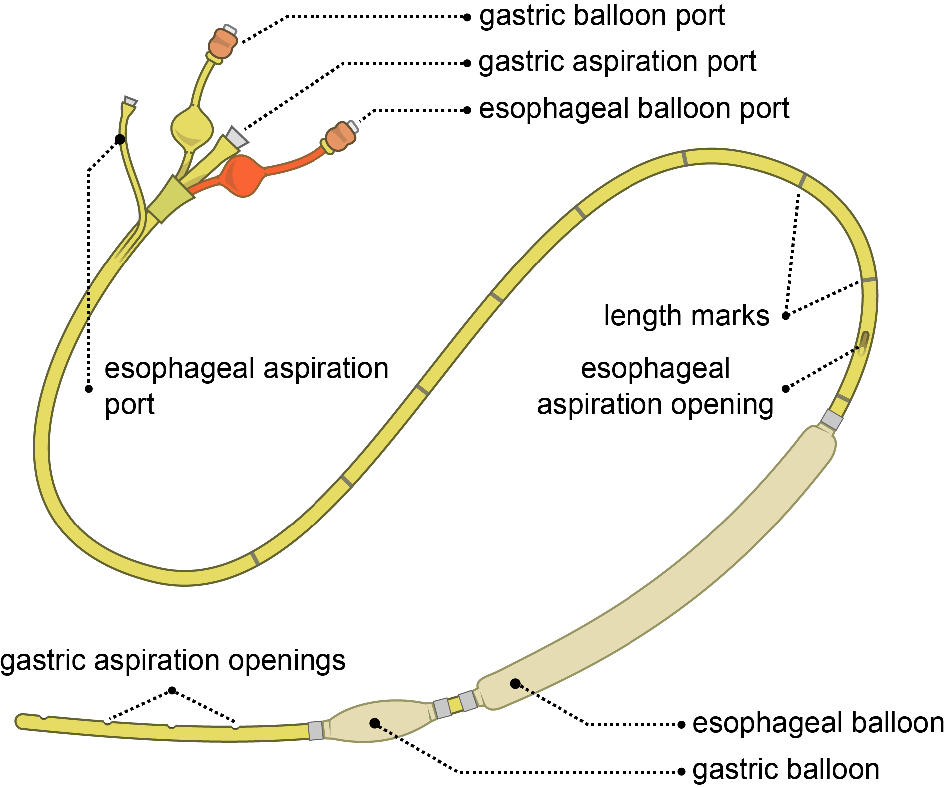 thumbnailSengstaken-Blakemore Tube Placement