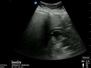 File:Severe hydro still image.jpg