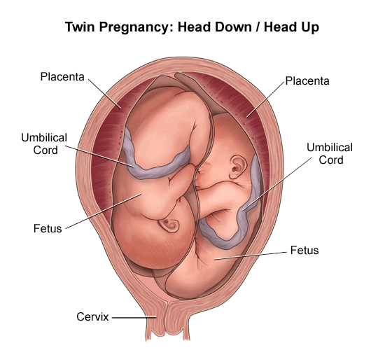 File:Twin breech.gif