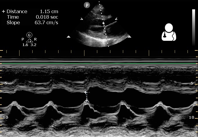 File:UOTW 14 - Ultrasound of the Week 3.jpg