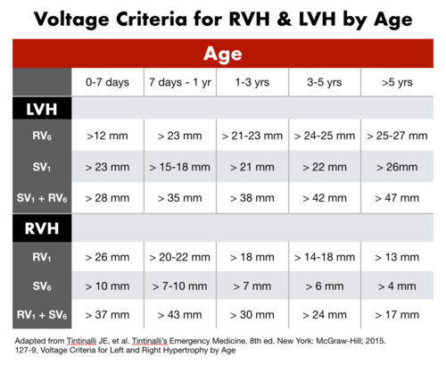 File:Voltage RVH-LVH.png