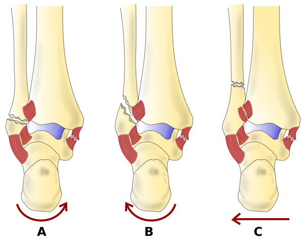 File:Weber Classification - latin.png