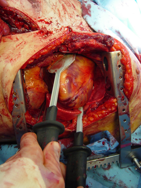 File:1459269 1749-7922-1-4-4.png