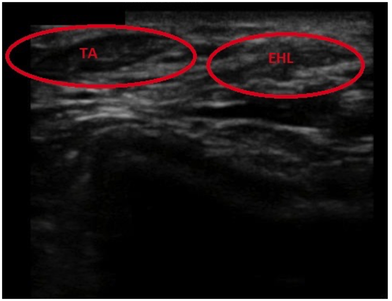 File:Ankle us anatomy.png
