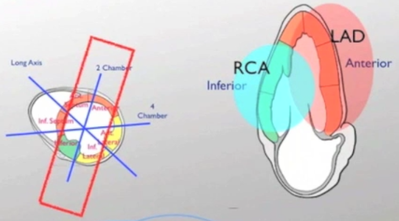 File:Apical Two Chamber View.png