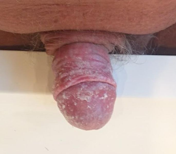 File:Balanite de Noon.jpg