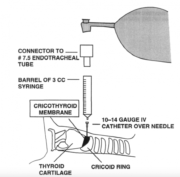 File:Barrel-connector.png