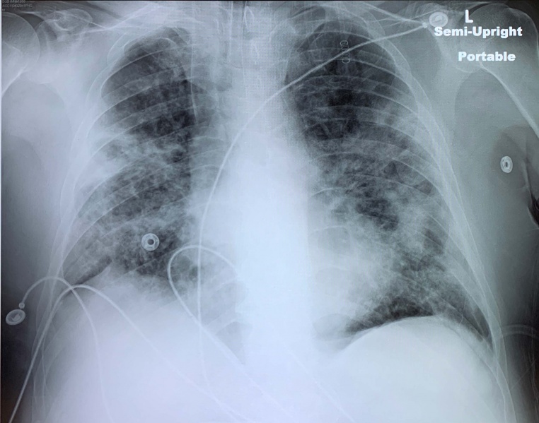 File:COVID one pager with links.jpg