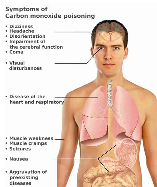 File:CO toxicity symptoms (en).jpg