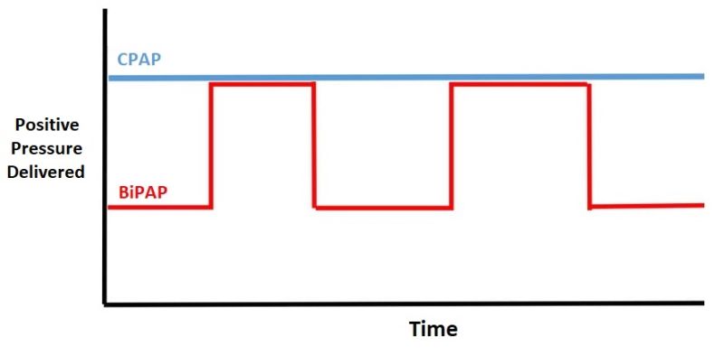 File:CPAPvsBiPAP.jpg