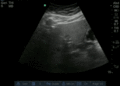 Thumbnail for version as of 11:55, 11 April 2016