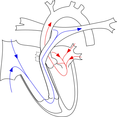 File:EbsteinAnomaly.svg