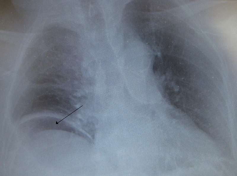 File:Free air2010.png