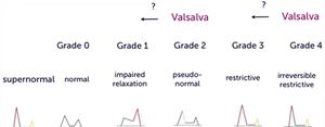 Grading diastolic dysfunction.JPG