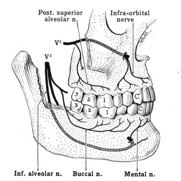 Buccal nerve block WikEM