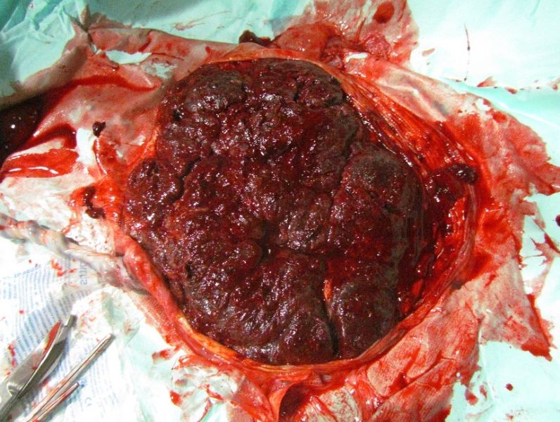 File:Human placenta 01.jpg