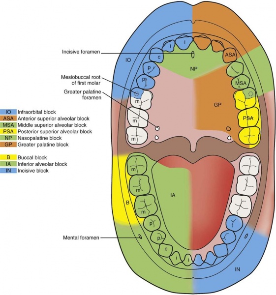 File:Innervation-of-the-tooth-9-anatomy-of-local-anesthesia-pocket-dentistry.jpg