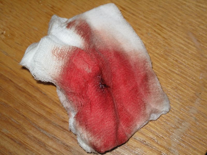 File:Krev na gázových čtvercích.jpg