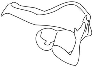 Legs over head PSVT.jpeg