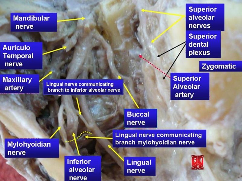 File:Mandibular nerve 3.jpg
