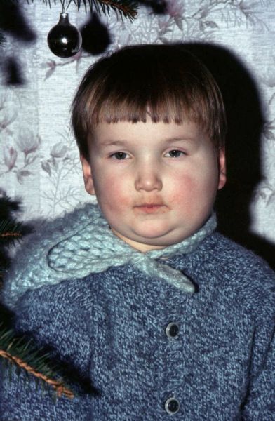 File:Mumps.jpg
