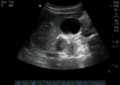 Thumbnail for version as of 21:31, 7 April 2016