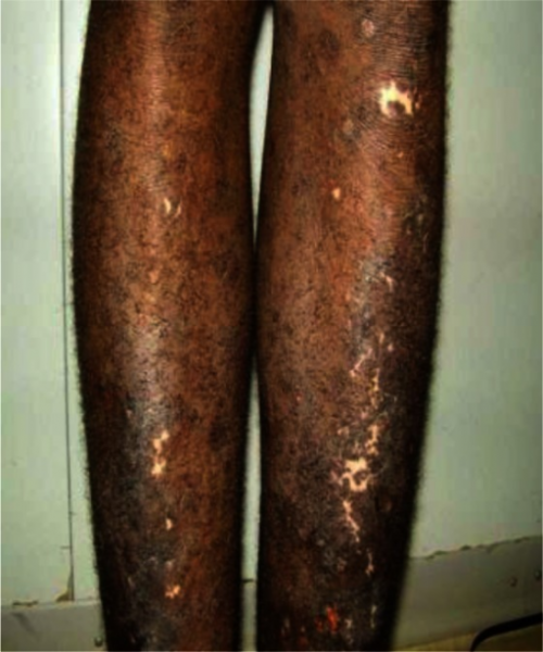 File:PMC3655252 IJPA-8-145-g004.png