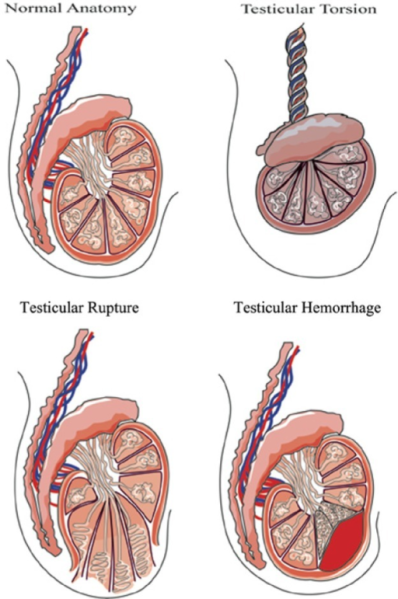 File:PMC4332640 10.1177 1941738114537786-fig4.png