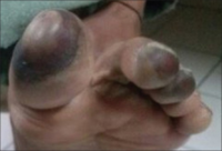 PMC4596071 IJOEM-19-121-g001.png