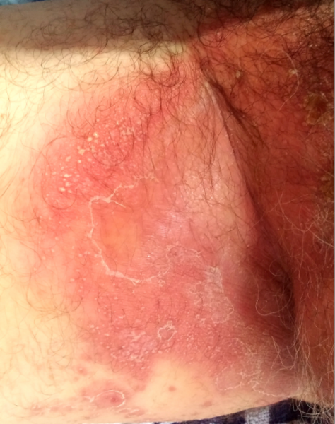 File:PMC4968311 gr1.png