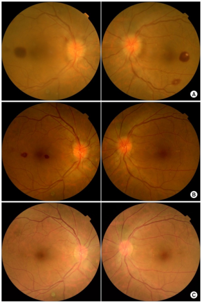 File:PMC5059132 kjtcv-49-408f1.png