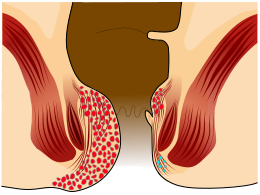 File:Piles Grade 4.svg
