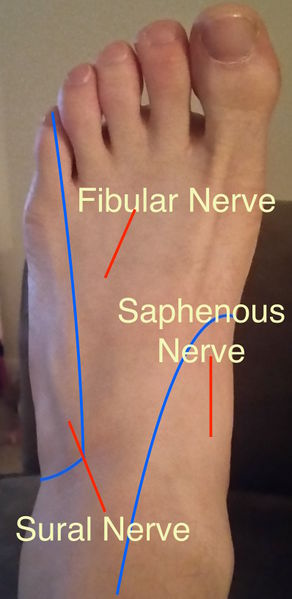 File:Plantar Foot Nerve Distribution.jpg