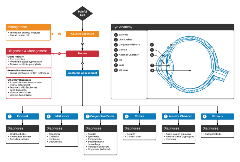 File:Red Eye - Advanced.png