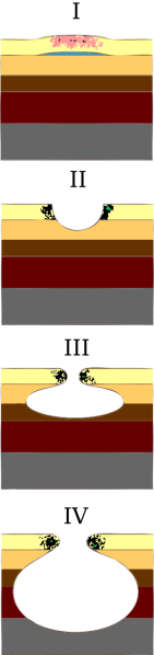 File:Schema stades escarres.png