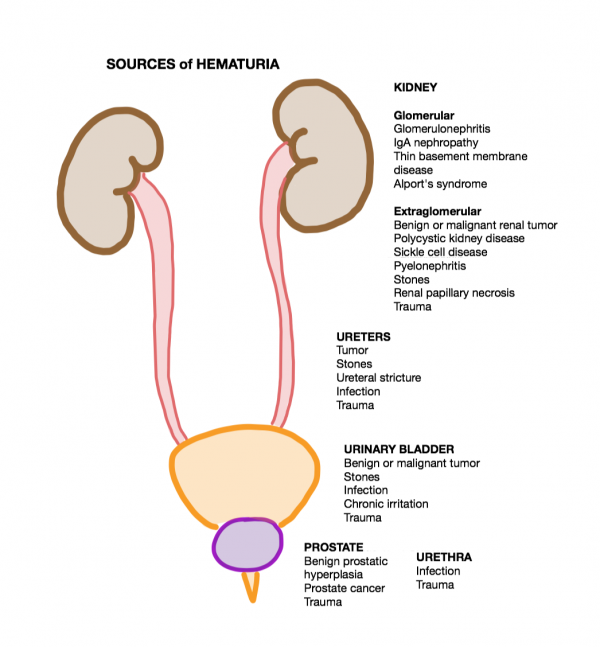 Glomerulonephritis WikEM