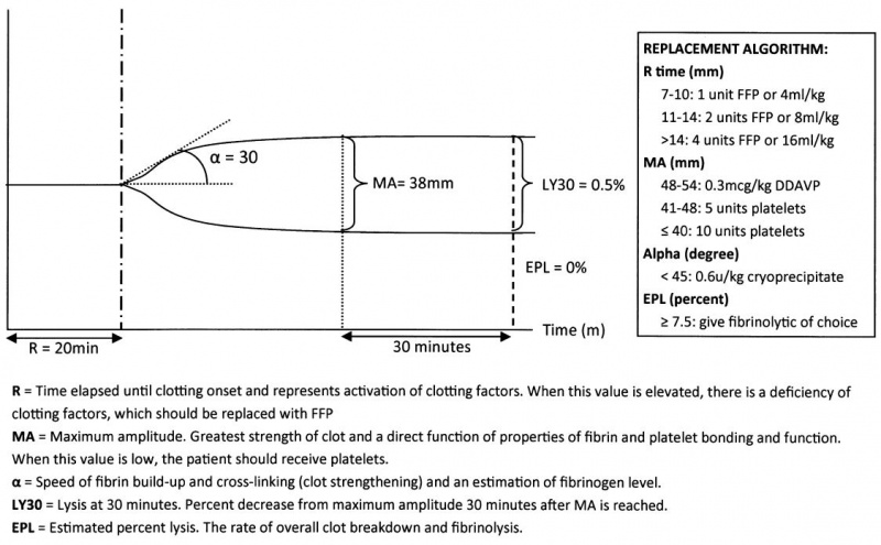 File:TEG Baylor Approach.JPG
