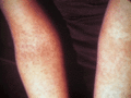 Thumbnail for version as of 02:44, 30 October 2016